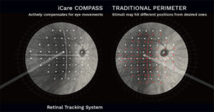 Active-Retina-Tracking