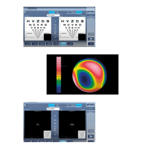 Advanced-Objective-Refraction