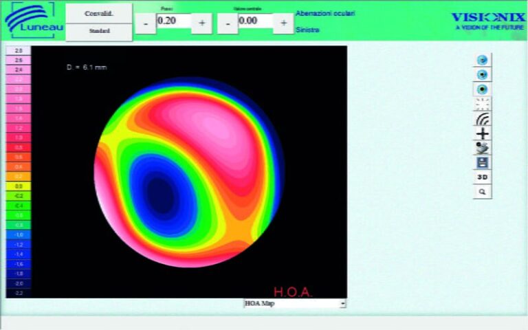 Visionix VX 110 Wavefront Anterior Segment Analyzer | shapeophthalmics.com