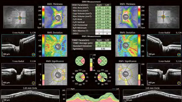 Optic-Disc