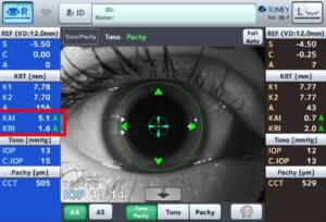 Refraction-mode-and-keratometry