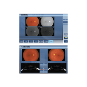 Visionix VX650 Wavefront Anterior Segment Analyzer