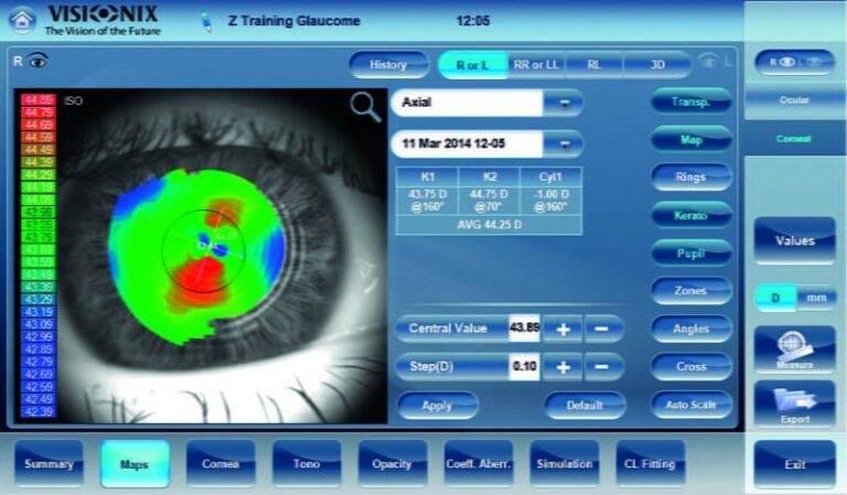 Visionix VX 110 Wavefront Anterior Segment Analyzer | shapeophthalmics.com