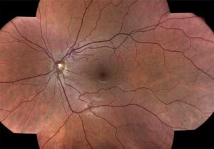 centervue-DRSplus-Fundus