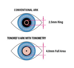 product-m3-pupil