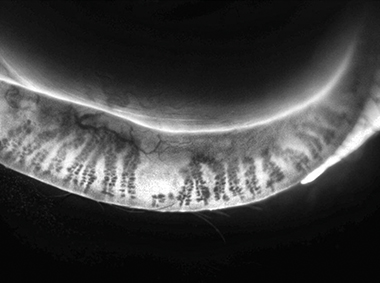 jjv_tearscience_dmiadaptive