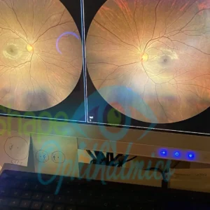 Carl Zeiss Clarus 500 Ultra Wide Field Fundus Camera | shapeophthalmics.com